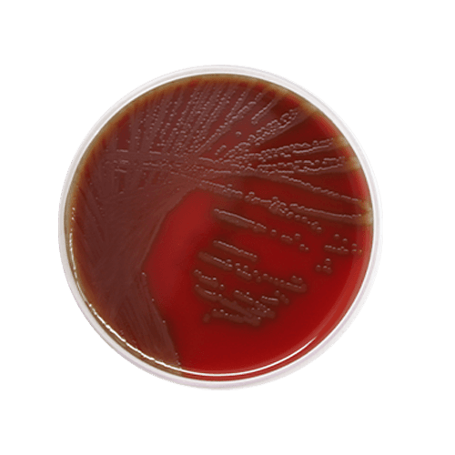 Agar-Sangue