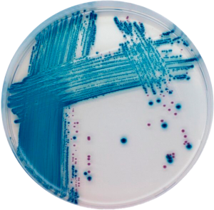 CHROMagar_STEC_site