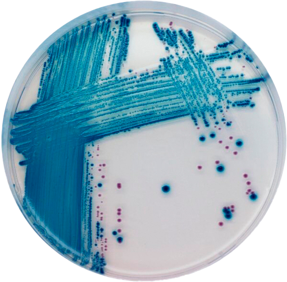 CHROMagar_STEC_site